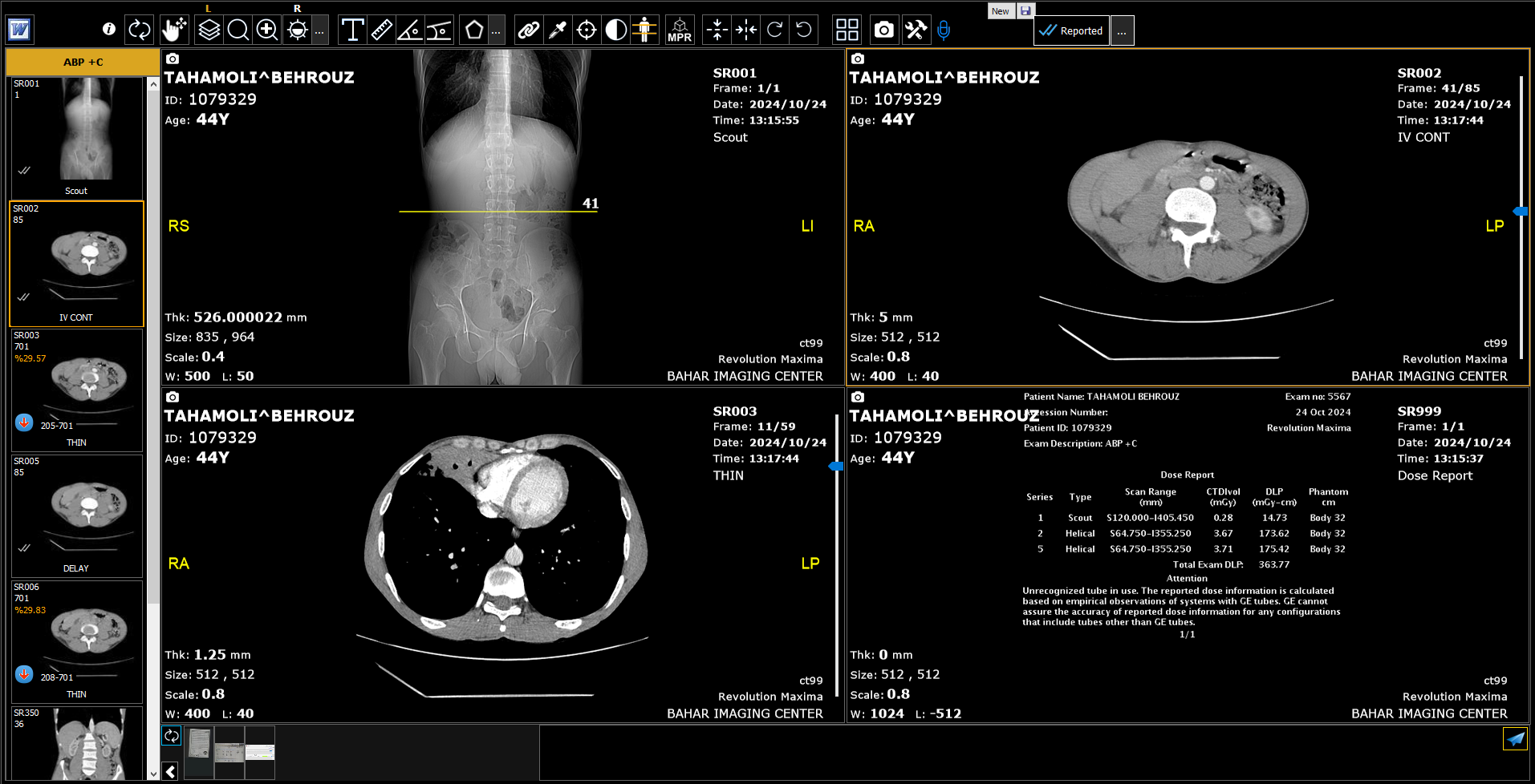 پکس CtScan