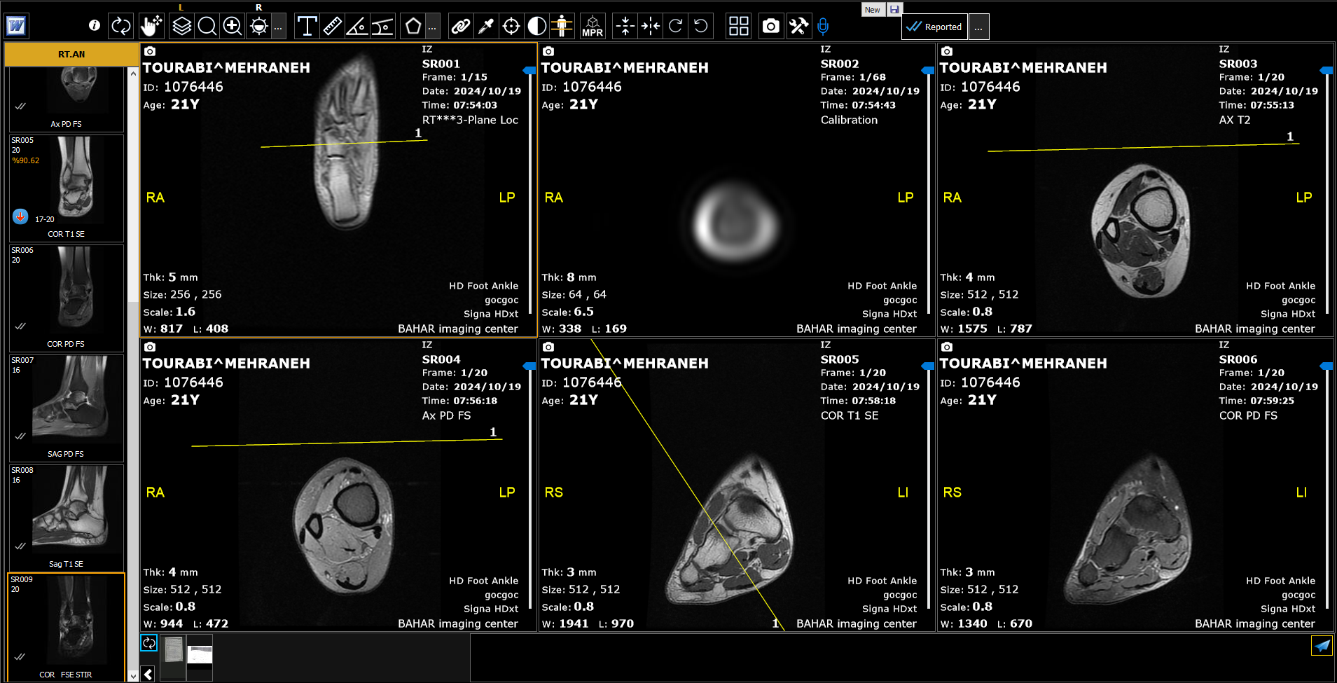 پکس MRI